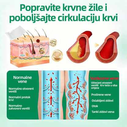 🇭🇷👨‍⚕️👍✅𝐇𝐞𝐚𝐥𝐫𝐢𝐳𝐞® 𝐕𝐞𝐢𝐧𝐓𝐚𝐫𝐠𝐞𝐭 𝐟𝐥𝐚𝐬𝐭𝐞𝐫 𝐬 𝐦𝐢𝐤𝐫𝐨𝐢𝐠𝐥𝐚𝐦𝐚⚡𝐓𝐫𝐞𝐧𝐮𝐭𝐧𝐨 𝐨𝐥𝐚𝐤š𝐚𝐧𝐣𝐞, 𝐝𝐮𝐠𝐨𝐫𝐨č𝐧𝐢 𝐫𝐞𝐳𝐮𝐥𝐭𝐚𝐭𝐢🎀