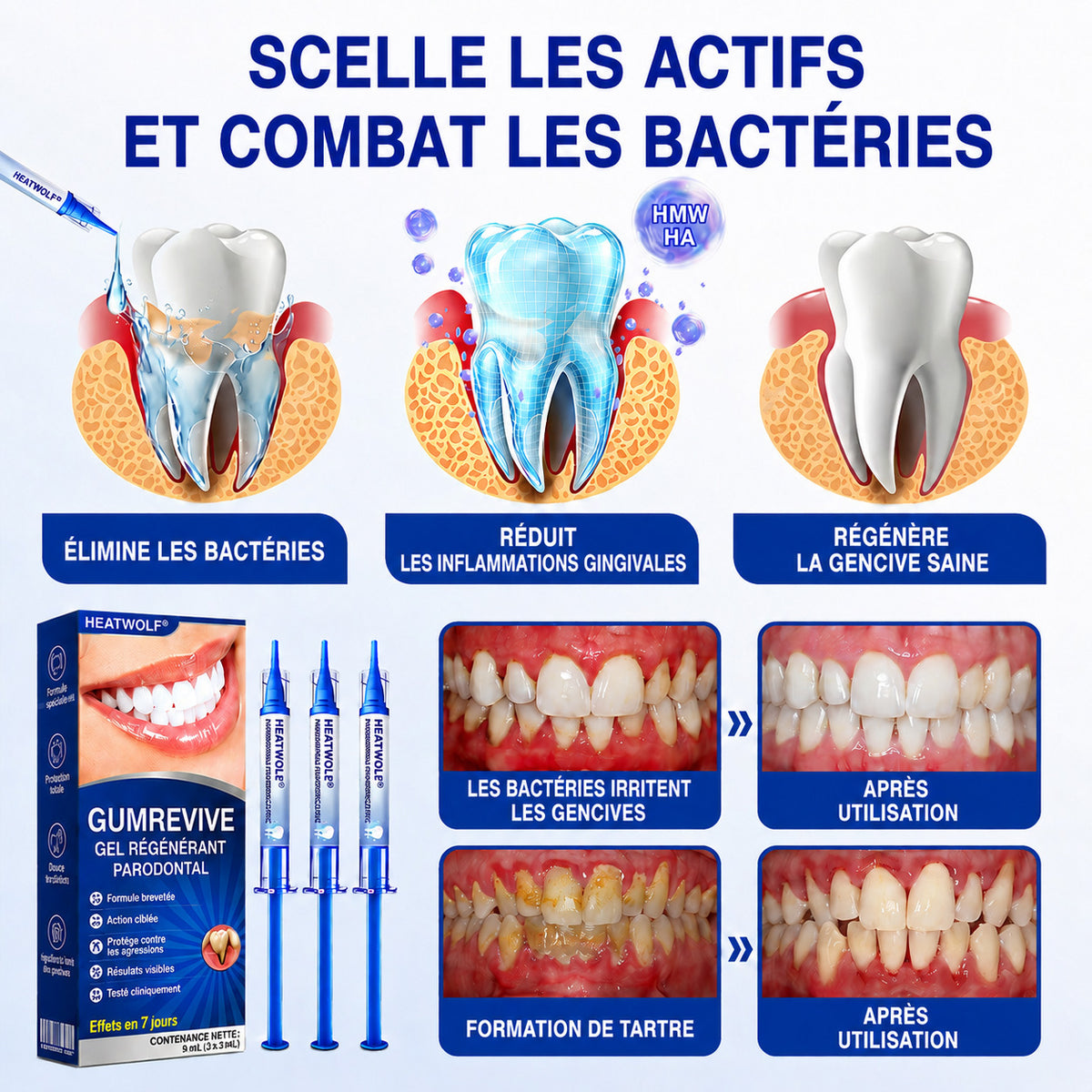 🇫🇷👨‍⚕️✅🦷 HEATWOLF® GumRevive – Gel réparateur parodontal 🦷✨1️⃣