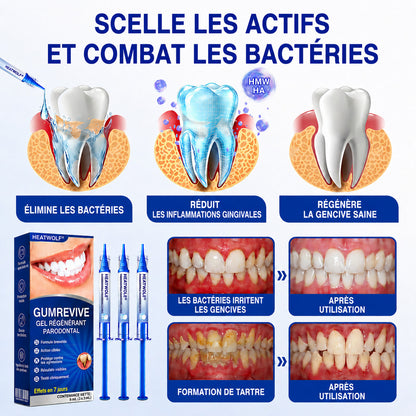 🇫🇷👨‍⚕️✅🦷 HEATWOLF® GumRevive – Gel réparateur parodontal 🦷✨1️⃣