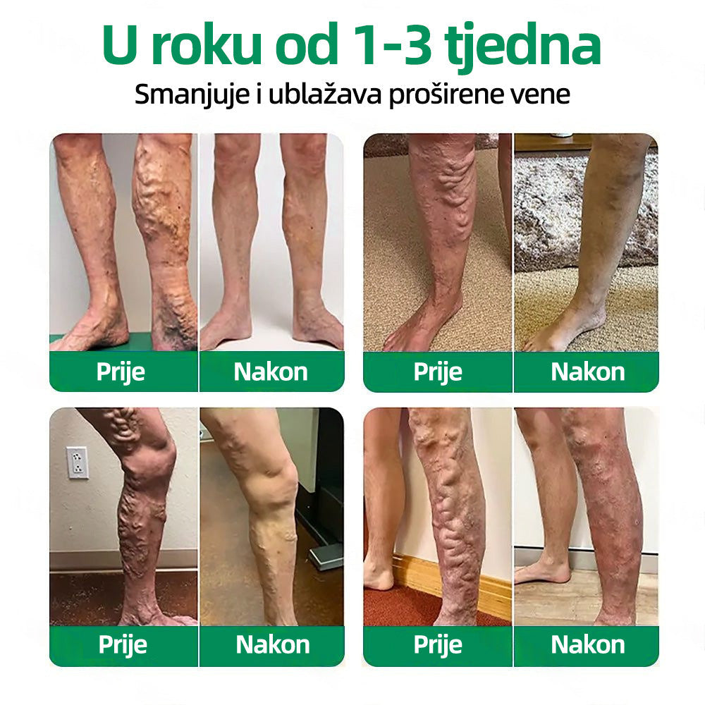 🇭🇷👨‍⚕️👍✅𝐇𝐞𝐚𝐥𝐫𝐢𝐳𝐞® 𝐕𝐞𝐢𝐧𝐓𝐚𝐫𝐠𝐞𝐭 𝐟𝐥𝐚𝐬𝐭𝐞𝐫 𝐬 𝐦𝐢𝐤𝐫𝐨𝐢𝐠𝐥𝐚𝐦𝐚⚡𝐓𝐫𝐞𝐧𝐮𝐭𝐧𝐨 𝐨𝐥𝐚𝐤š𝐚𝐧𝐣𝐞, 𝐝𝐮𝐠𝐨𝐫𝐨č𝐧𝐢 𝐫𝐞𝐳𝐮𝐥𝐭𝐚𝐭𝐢🌸