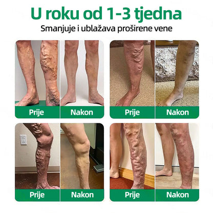 🇭🇷👨‍⚕️👍✅𝐇𝐞𝐚𝐥𝐫𝐢𝐳𝐞® 𝐕𝐞𝐢𝐧𝐓𝐚𝐫𝐠𝐞𝐭 𝐟𝐥𝐚𝐬𝐭𝐞𝐫 𝐬 𝐦𝐢𝐤𝐫𝐨𝐢𝐠𝐥𝐚𝐦𝐚⚡𝐓𝐫𝐞𝐧𝐮𝐭𝐧𝐨 𝐨𝐥𝐚𝐤š𝐚𝐧𝐣𝐞, 𝐝𝐮𝐠𝐨𝐫𝐨č𝐧𝐢 𝐫𝐞𝐳𝐮𝐥𝐭𝐚𝐭𝐢🎀