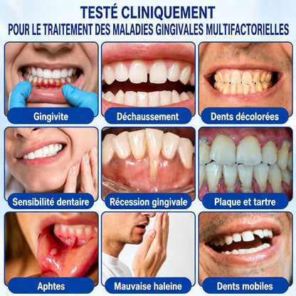🇫🇷👨‍⚕️✅🦷 HEATWOLF® GumRevive – Gel réparateur parodontal 🦷✨1️⃣