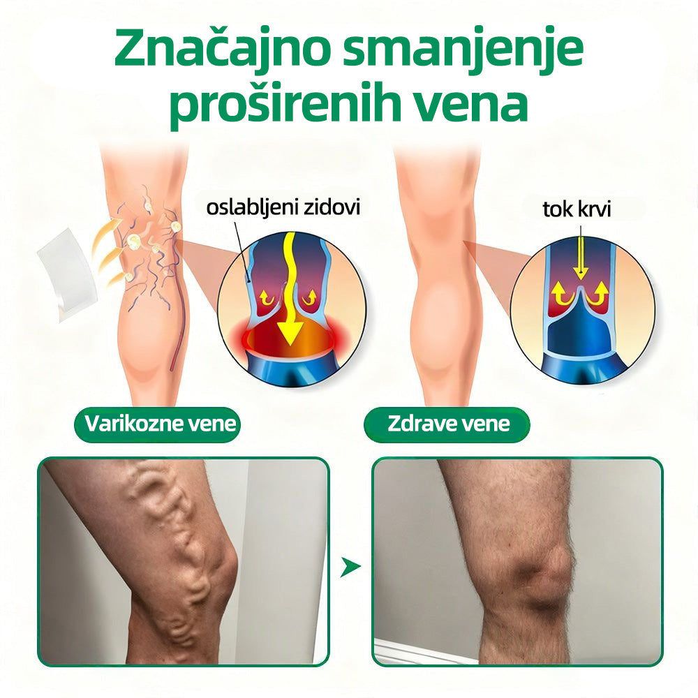 🇭🇷👨‍⚕️👍✅𝐇𝐞𝐚𝐥𝐫𝐢𝐳𝐞® 𝐕𝐞𝐢𝐧𝐓𝐚𝐫𝐠𝐞𝐭 𝐟𝐥𝐚𝐬𝐭𝐞𝐫 𝐬 𝐦𝐢𝐤𝐫𝐨𝐢𝐠𝐥𝐚𝐦𝐚⚡𝐓𝐫𝐞𝐧𝐮𝐭𝐧𝐨 𝐨𝐥𝐚𝐤š𝐚𝐧𝐣𝐞, 𝐝𝐮𝐠𝐨𝐫𝐨č𝐧𝐢 𝐫𝐞𝐳𝐮𝐥𝐭𝐚𝐭𝐢🌸