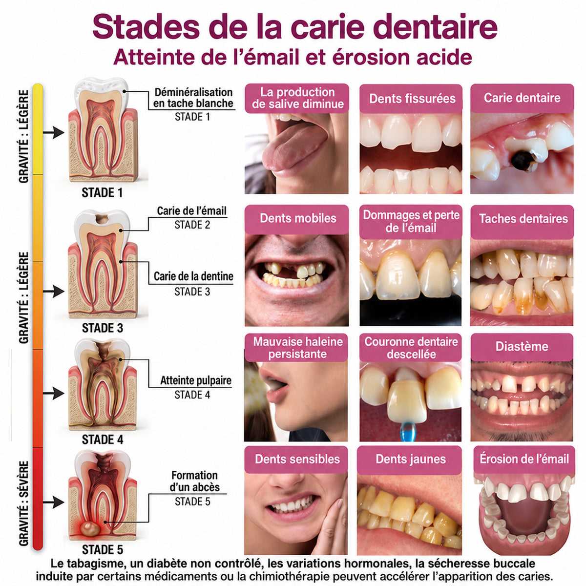 HEATWOLF® DenPerm – Gel naturel d’émail dentaire pour le traitement des caries (Copie)