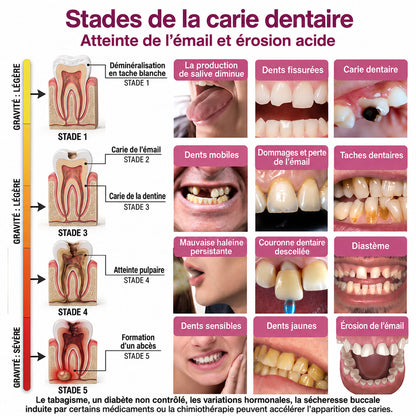 HEATWOLF® DenPerm – Gel naturel d’émail dentaire pour le traitement des caries (Copie)