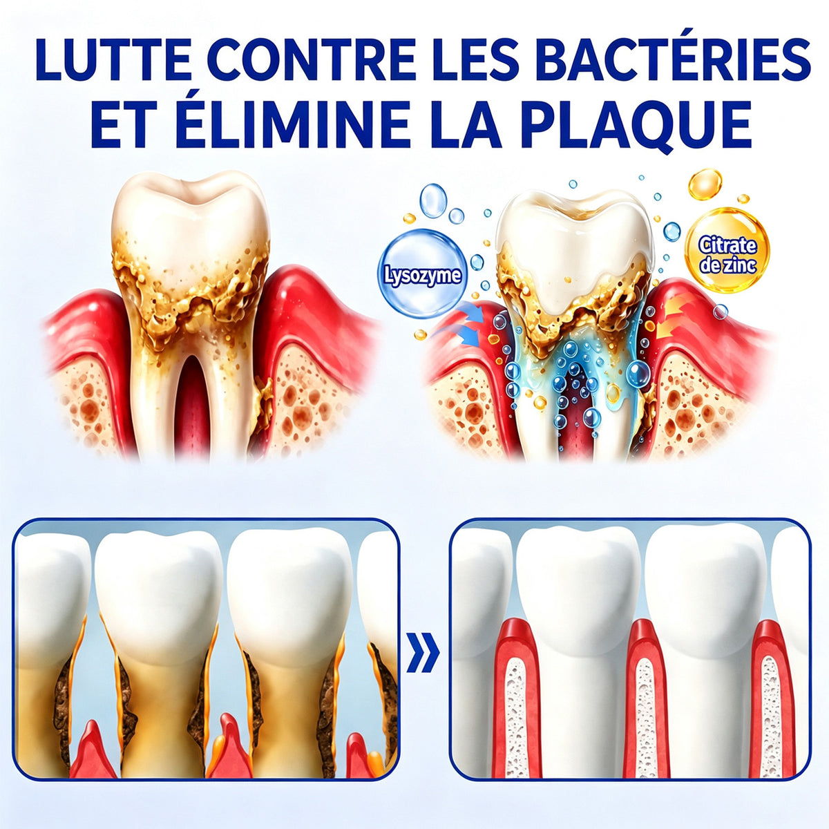 🇫🇷👨‍⚕️✅🦷 HEATWOLF® GumRevive – Gel réparateur parodontal 🦷✨1️⃣