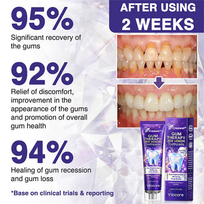 Creawel® VioCore Bee Venom Dental Treatment Toothpaste🔥