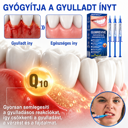 🇫🇷👨‍⚕️✅🦷 HEATWOLF® GumRevive – Gel réparateur parodontal 🦷✨🔥🔥🔥