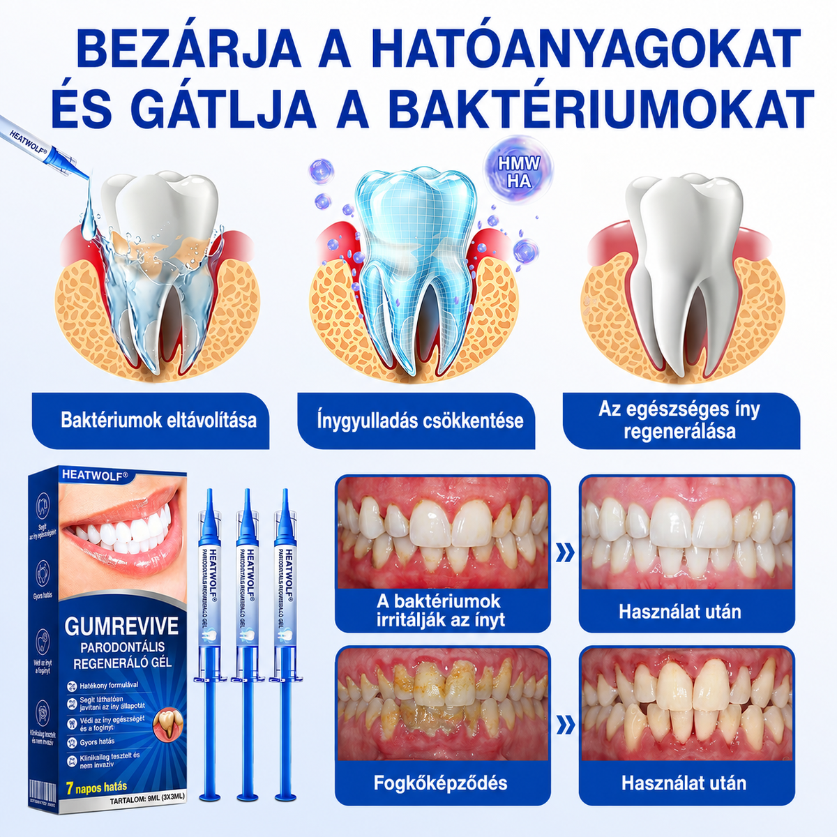 🇫🇷👨‍⚕️✅🦷 HEATWOLF® GumRevive – Gel réparateur parodontal 🦷✨🔥🔥🔥