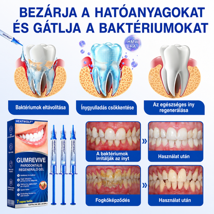🇫🇷👨‍⚕️✅🦷 HEATWOLF® GumRevive – Gel réparateur parodontal 🦷✨🔥🔥🔥