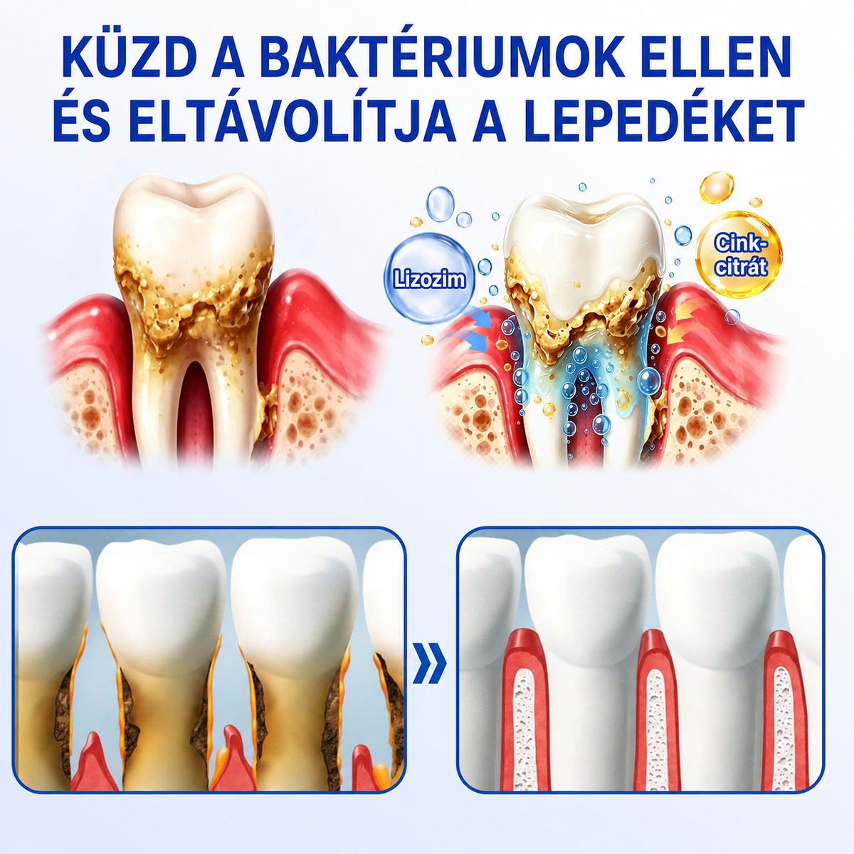 🇫🇷👨‍⚕️✅🦷 HEATWOLF® GumRevive – Gel réparateur parodontal 🦷✨🔥🔥🔥