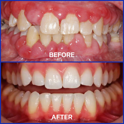 Creawel® VioCore Bee Venom Dental Treatment Toothpaste🔥