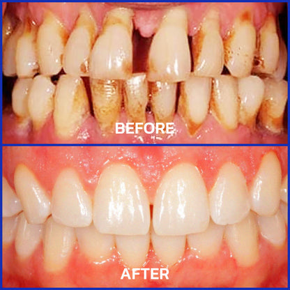 Creawel® VioCore Bee Venom Dental Treatment Toothpaste🔥
